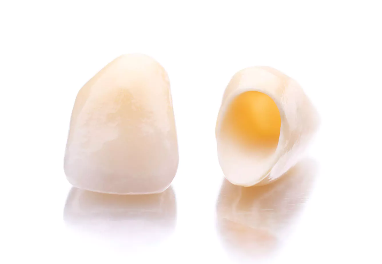 「美しさと機能性を兼ね備えた」セラミックによる治療