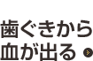 case04 歯ぐきから血が出る